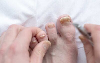 Nail Treatment Revolution