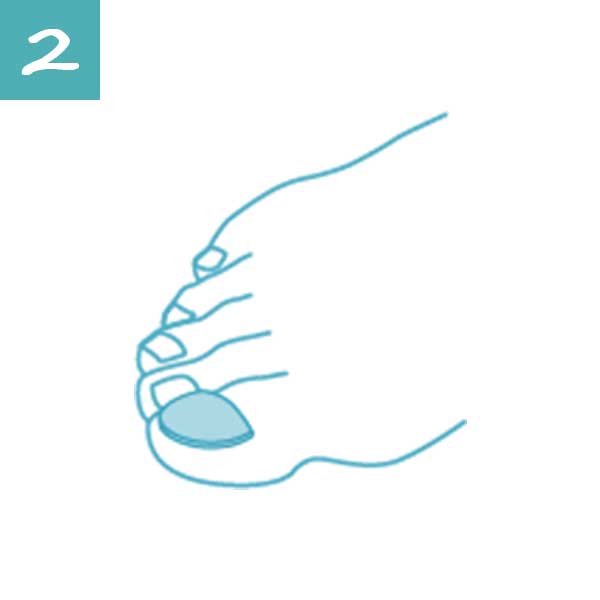 Apply a small disc directly on the affected nail